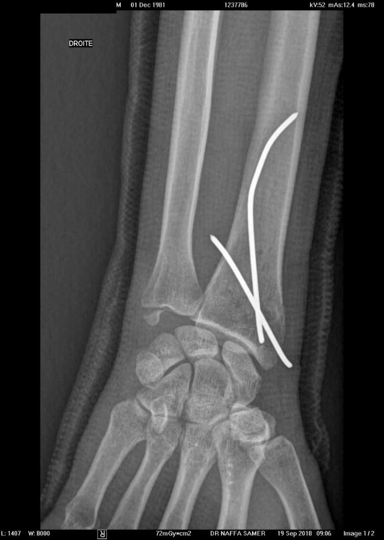 0_1540190668852_image1 (3).jpg